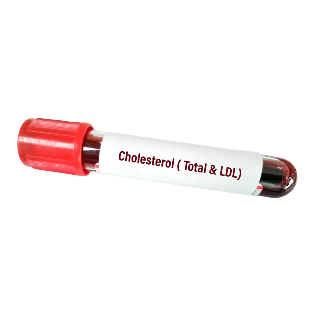 Cholesterol